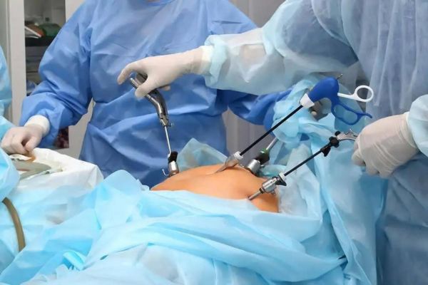 laparoscopic surgery ahilya nagar