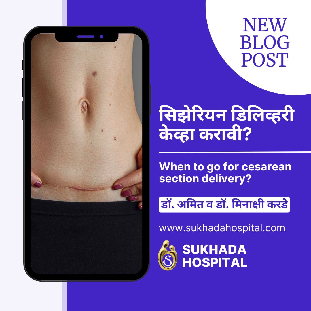 सिझेरियन डिलिव्हरी केव्हा करावी